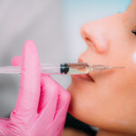 Dermal Filler Injection for Cheeks